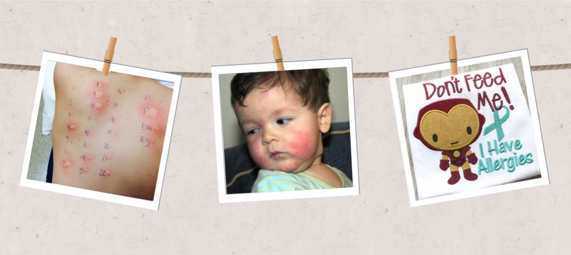 حساسية القمح الغلوتين عند الأطفال