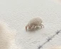 مرض السكايبوس ينخر بأجساد الأسيرات