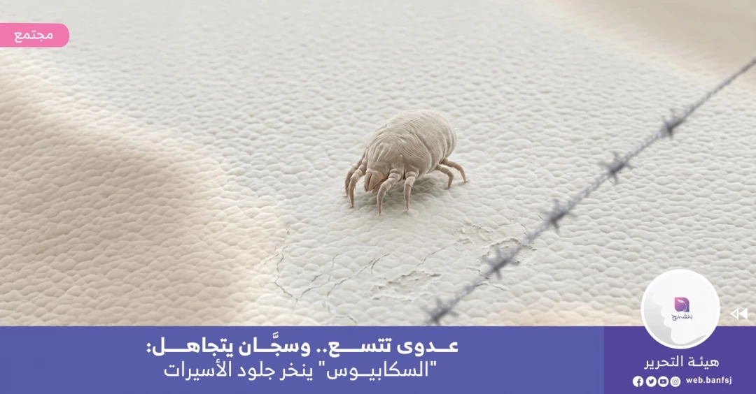 مرض السكايبوس ينخر بأجساد الأسيرات
