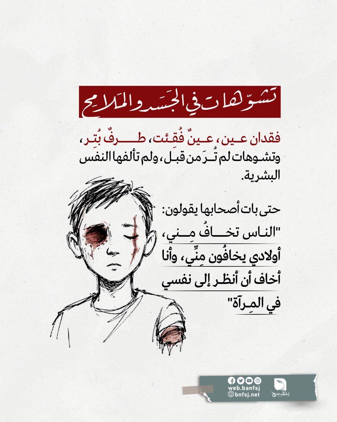تشوهات بفعل الحرب