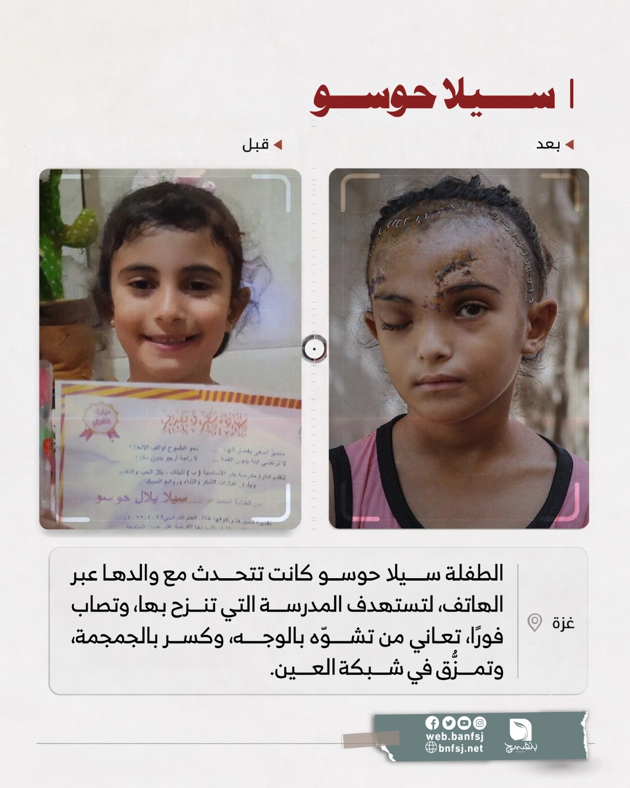 سيلا حوسو