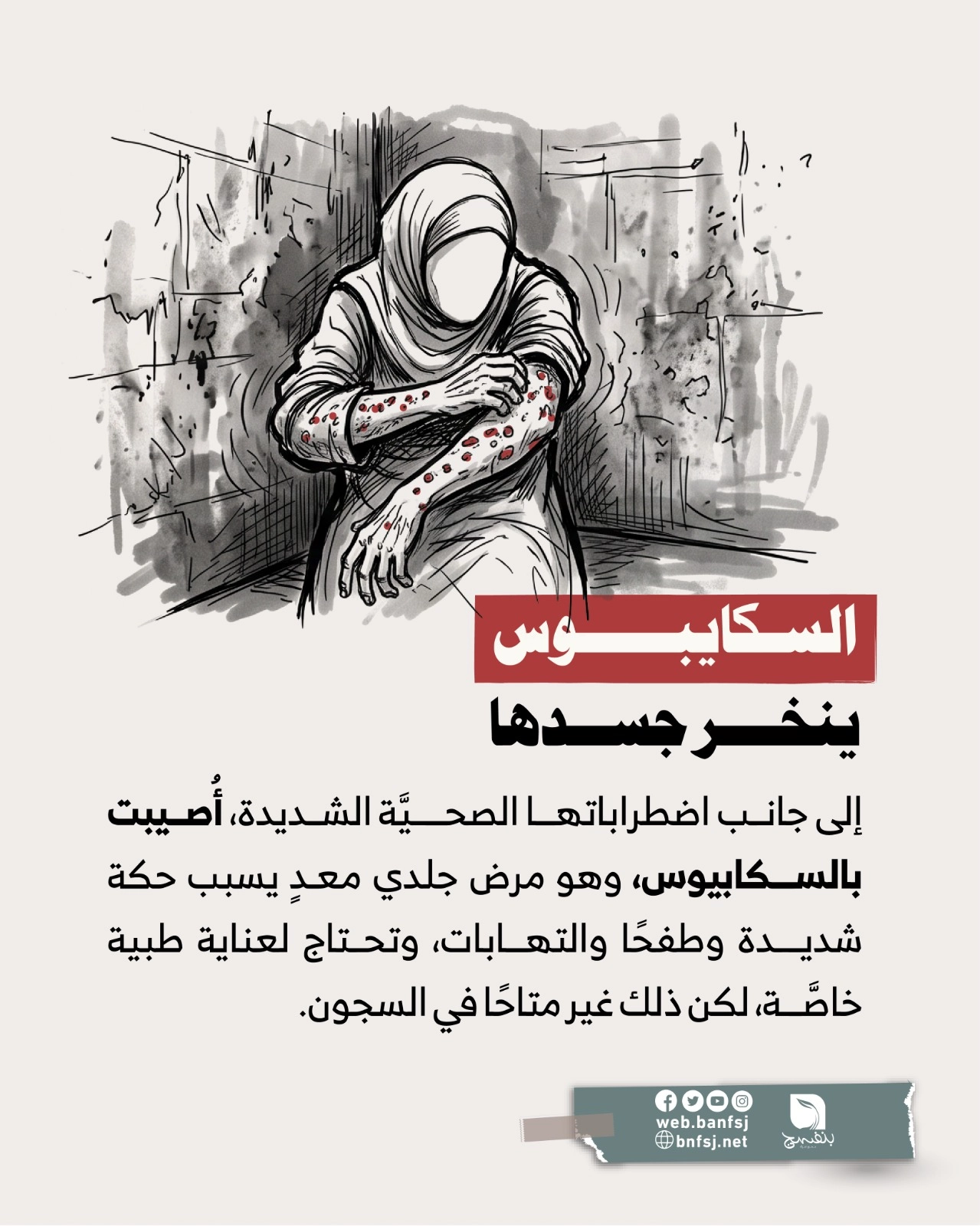 مرض السكايبوس.jpg